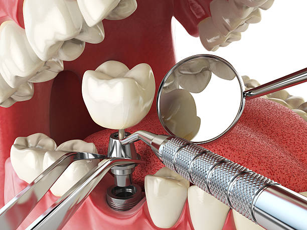 Best Dental Abscess Treatment in Meadow Vale, KY
